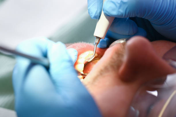 Best Urgent Tooth Repair  in Captains Cove, VA